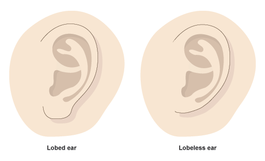 A diagram of a lobed ear and a lobeless ear (http://www.bbc.co.uk/staticarchive/7b37accae664723d3f6d3d4cc10c9ebda67cd28d.gif)