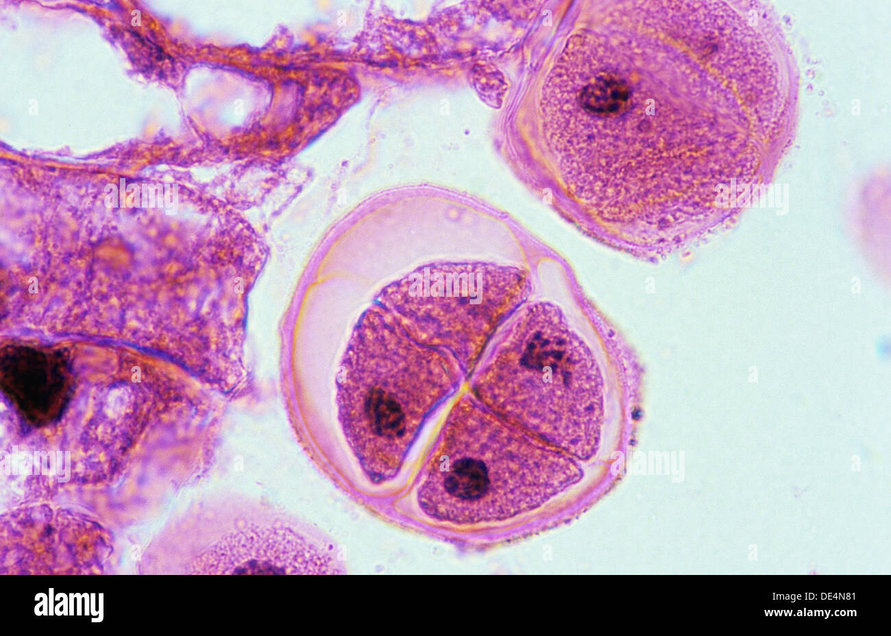 (http://c8.alamy.com/comp/DE4N81/meiosis-in-lilium-anther-telophase-ii-1000-x-optical-microscope-photomicrography-DE4N81.jpg)