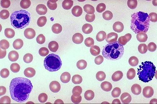 (http://www.pathologystudent.com/wp-content/uploads/2009/04/leukocytes.jpg)