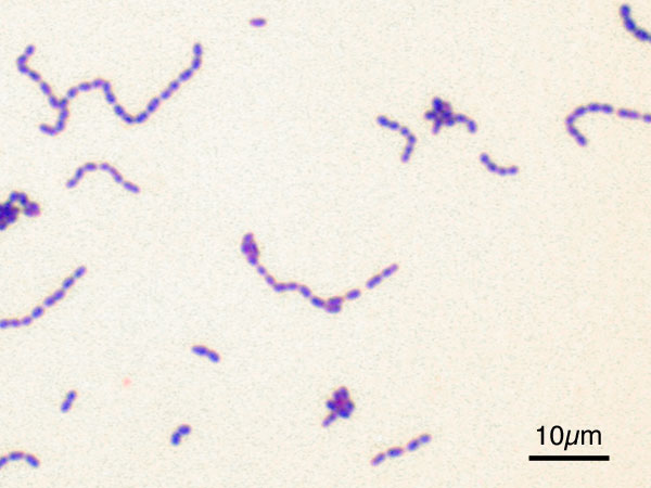 (http://upload.wikimedia.org/wikipedia/commons/4/4d/Streptococcus_mutans_Gram.jpg)