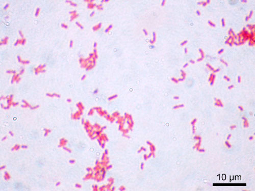 (http://janiceatmeredith.files.wordpress.com/2012/01/escherichia-coli2.jpg)